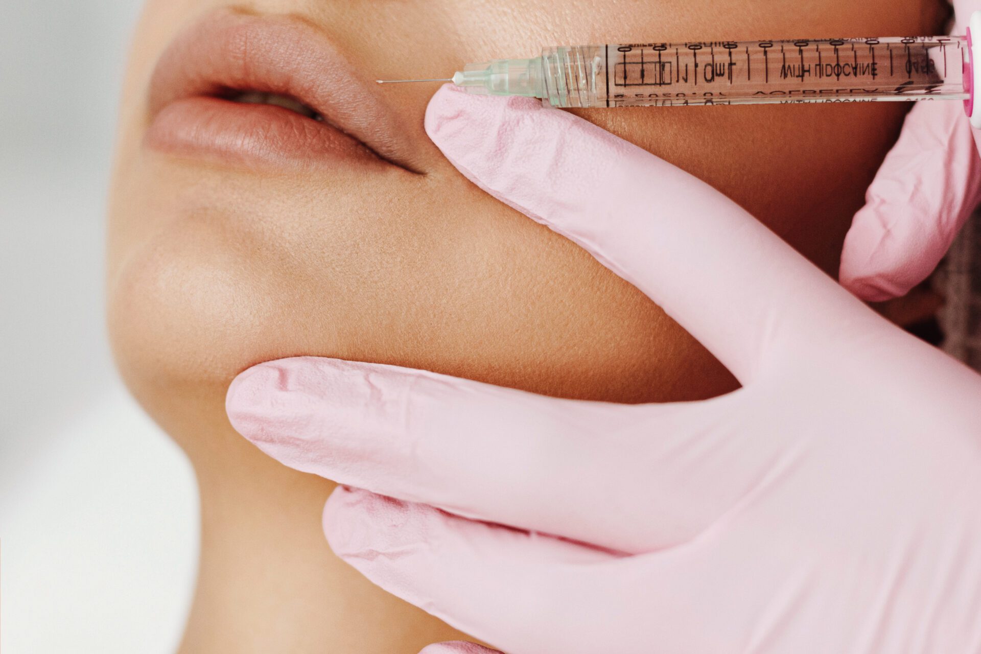 Young Woman Receiving Hyaluronic Acid Injection in lips