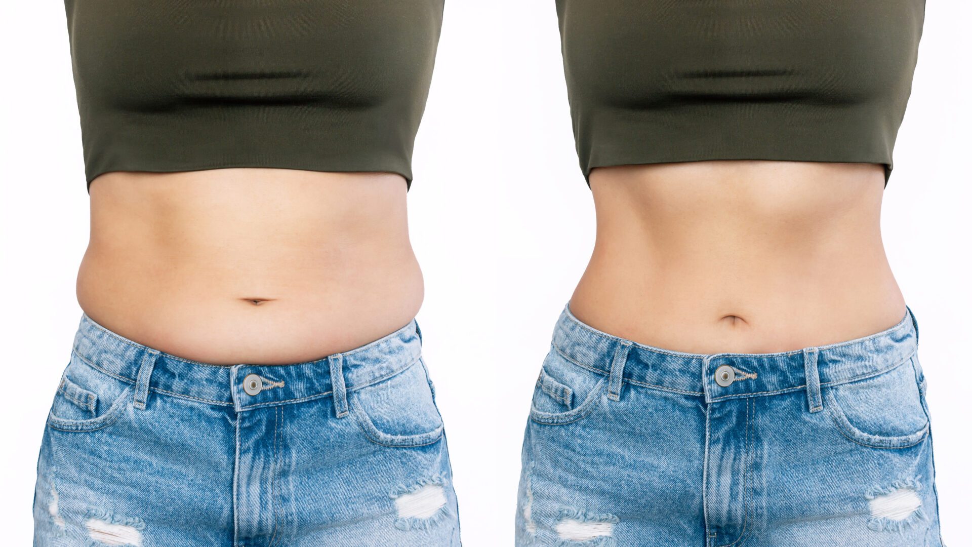 Before and after comparison of a woman's midsection showing weight loss